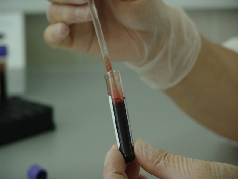 kolik stojí těhotenský krevní test bez pojištění