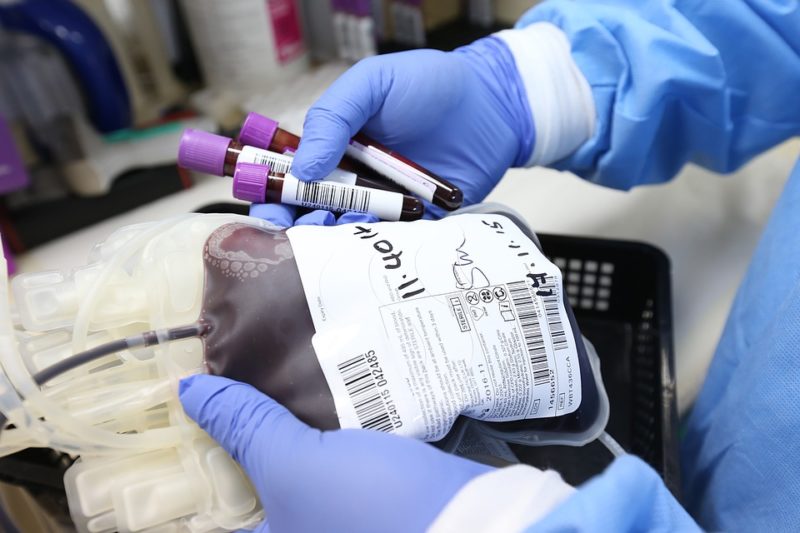 How to lower hematocrit for plasma donation