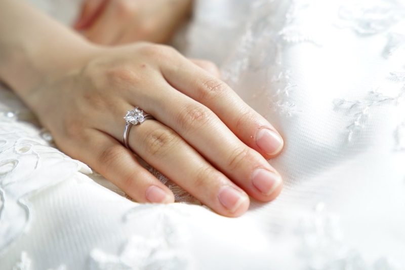 how to get rid of wedding ring rash